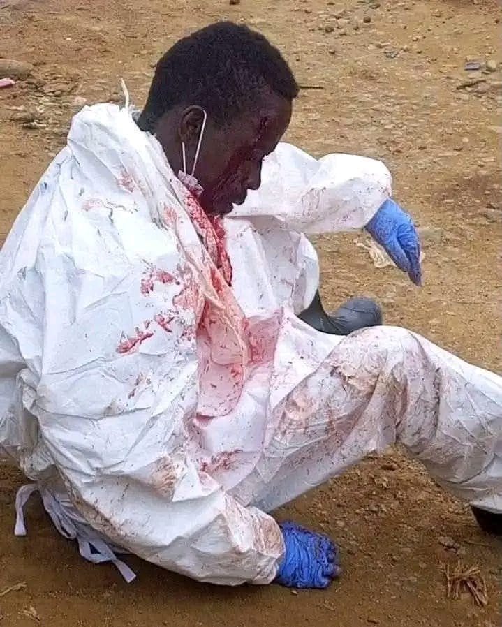 RDC : un agent de la riposte contre Ebola violemment agressé en plein exercice de ses fonctions à Beni